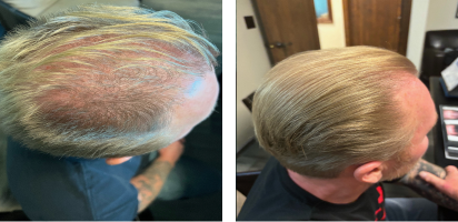 Clean, professional medical spa treatment room with neutral tones at Palm Beach HealthWorks - Hair Replacement | Wellness & Weight Loss | TRT Therapy in Palm Beach Gardens
