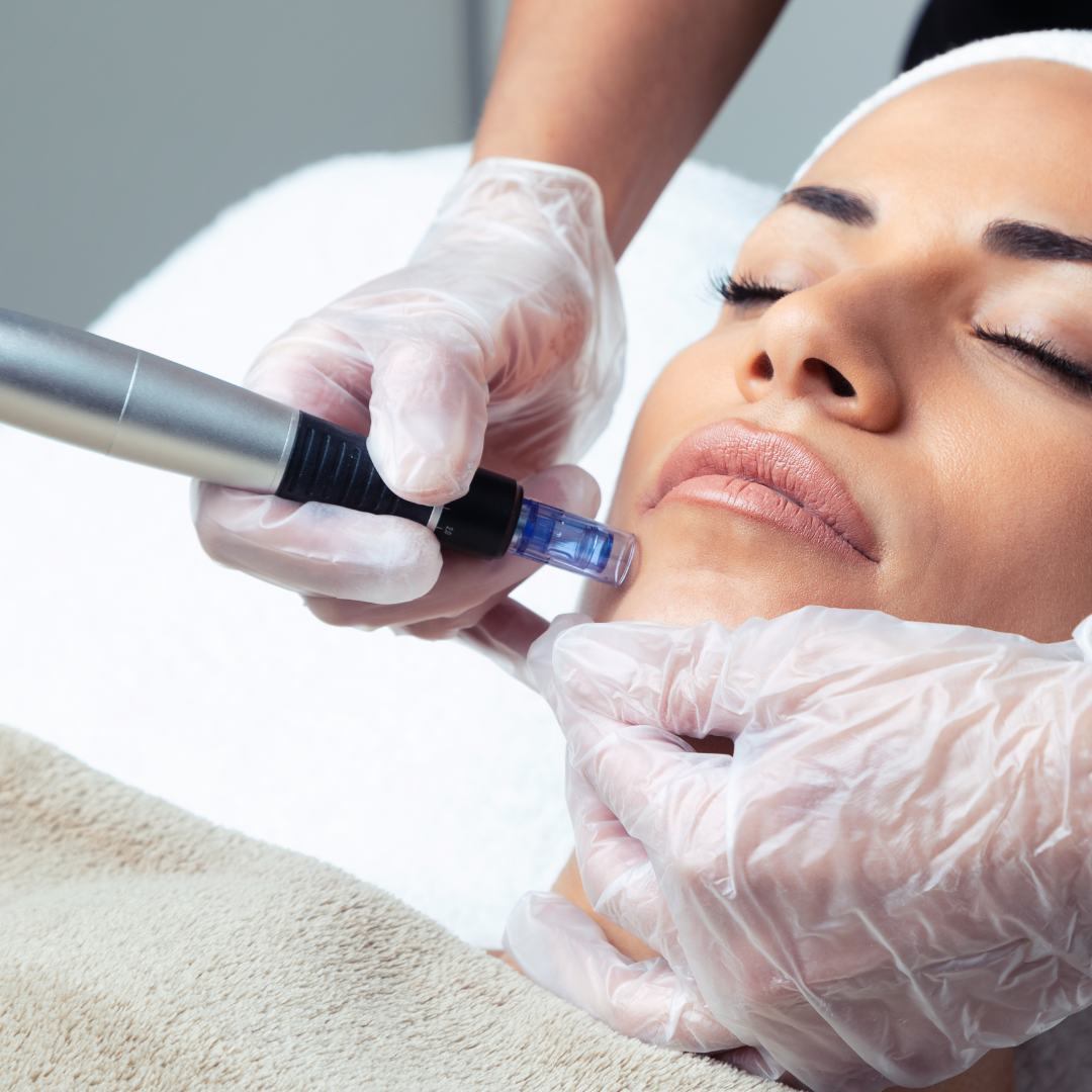 Best microneedling with exosomes palm beach cost