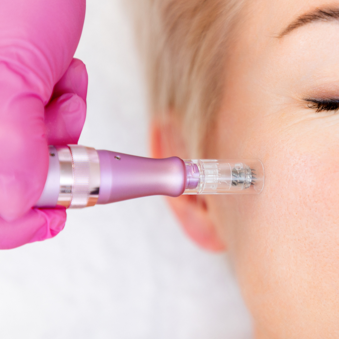 microneedling in Palm Beach Gardens