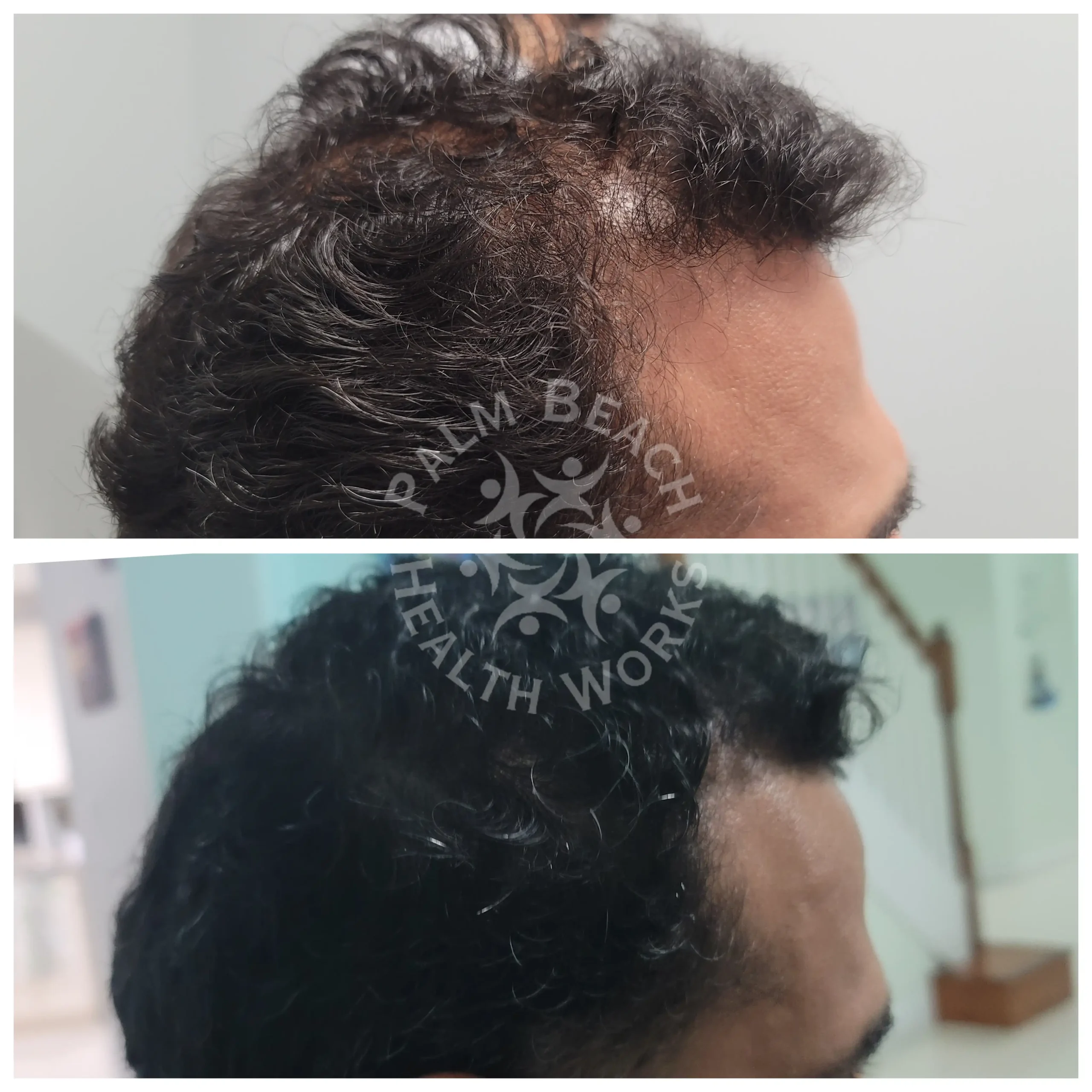 After-before-06