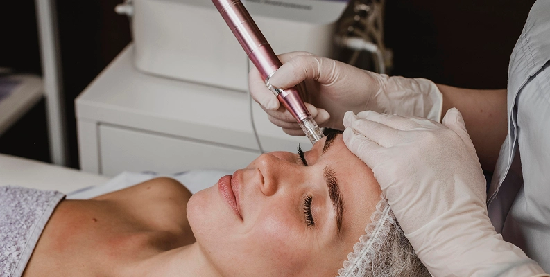 Microneedling with Stem Cells_Exosomes Works img