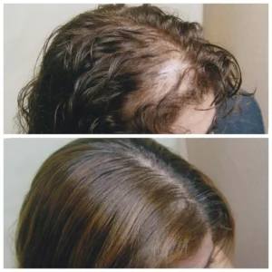 Femal_Before_After_1