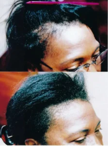 Femal_Before_After_2