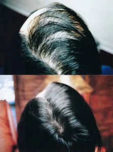 Femal_Before_After_3