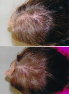 Femal_Before_After_7