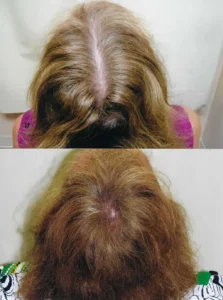 Femal_Before_After_8