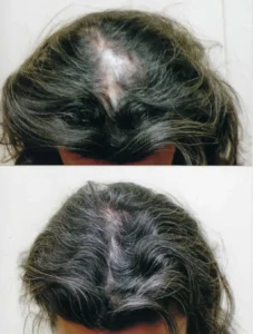 Femal_Before_After_9