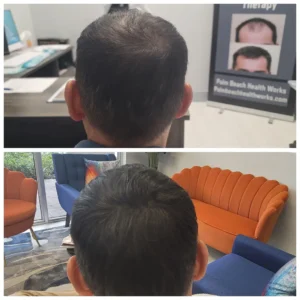 Men Hair Treatment_3