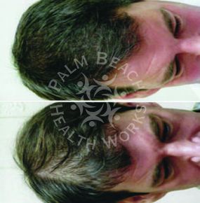Men Hair Treatment_img11
