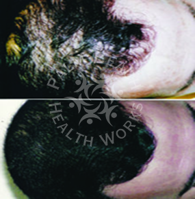 Men Hair Treatment_img5