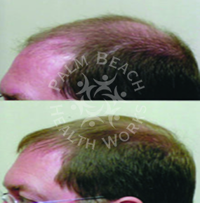 Men Hair Treatment_img7