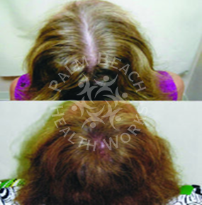 Women Hair Treatment_img1