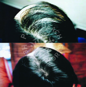Women Hair Treatment_img2