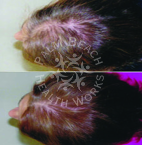Women Hair Treatment_img3