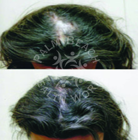Women Hair Treatment_img4