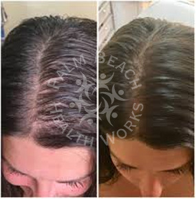 Women Hair Treatment_img5
