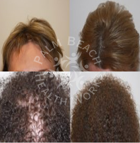 Women Hair Treatment_img6