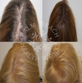 Women Hair Treatment_img7