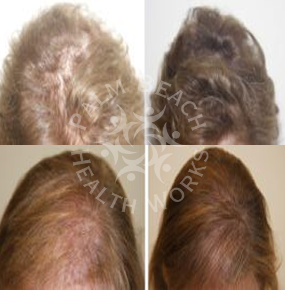 Women Hair Treatment_img8