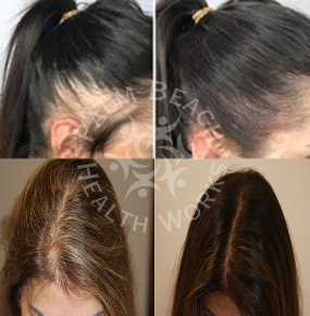 Women Hair Treatment_img9